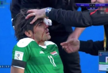 Hậu vệ của ĐT Iraq nhập viện, thở ô xy sau khi đấu ĐT Việt Nam