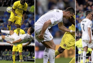 Tin bóng đá TBN 21/4: Zidane áy náy trước chấn thương của học trò