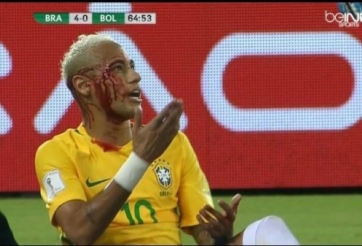 VIDEO: Pha va chạm khiến Neymar 'máu chảy bê bết'