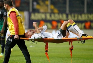 Van Persie suýt mù mắt sau pha va chạm mạnh