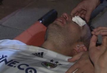 VIDEO: Pha va chạm khiến Van Persie suýt mù 1 mắt