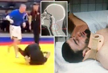 Dùng sai đòn xoay 360 độ, võ sĩ gãy cổ 'rợn người'