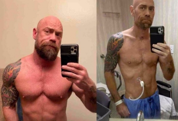 Nam y tá to lớn như lực sĩ bỗng 'teo nhỏ' vì Covid-19