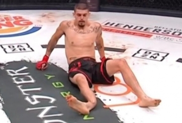 Võ sĩ MMA gãy chân kinh dị sau pha ra đòn trúng đối phương