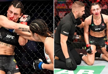 Giả vờ bắt tay để đánh lén, nữ võ sĩ MMA nhận quả báo đáng đời