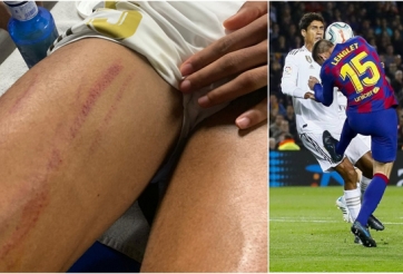 Bằng chứng Varane bị trung vệ Barca 'chặt chém' tơi tả