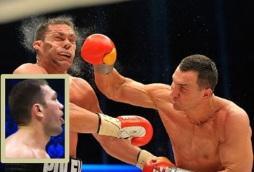 VIDEO: Mải thè lưỡi cà khịa, 'Rắn hổ mang' lãnh cú đấm nghìn cân 