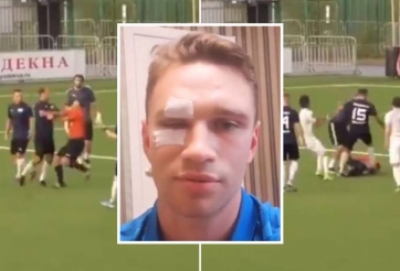 VIDEO: Cựu đội trưởng tuyển Nga đánh trọng tài nhập viện