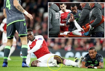 SỐC: Welbeck có thể nghỉ bóng đá vì chấn thương