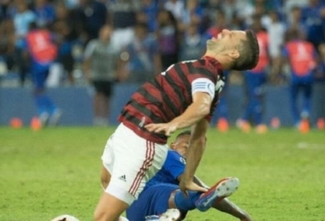 Cựu sao Juventus gặp chấn thương ghê rợn