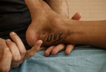 Bi kịch Cazorla: Bị cắt 8cm chân vẫn phải phẫu thuật lần 9