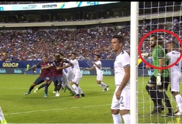 VIDEO: Thêm 1 vụ 'cắn người' xảy ra trên sân cỏ thế giới