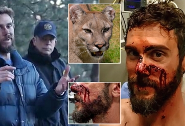 Bị tấn công, VĐV chạy bộ dùng Nhu Thuật siết chết báo sư tử Mỹ