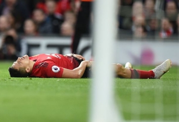Xác định chấn thương nặng của Alexis Sanchez