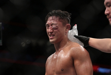 Võ sĩ Hàn Quốc gần mù mắt vì lĩnh trọn cú đấm 'tử thần' 