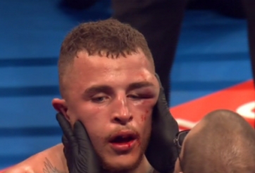 VIDEO: Võ sĩ biến dạng khuôn mặt vì lĩnh trọn cú đấm 'sấm sét'