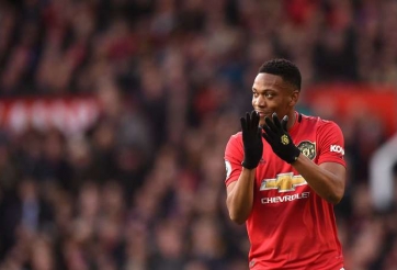 CĐV 'phát sốt' vì ngoại hình mới của Martial