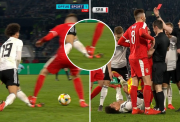 VIDEO: Cận cảnh chấn thương kinh hoàng của Sane