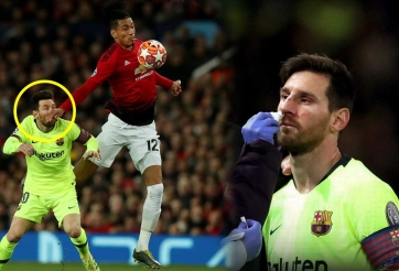 Smalling tiết lộ những gì Messi nói sau pha va chạm đổ máu