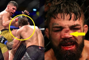 VIDEO: Võ sĩ lên gối cực mạnh khiến đối thủ gãy mũi, phải nhập viện