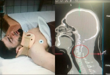 Võ sĩ Nga gãy cổ vì dính đòn của đối thủ