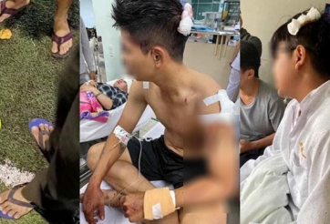 Cầu thủ phủi Việt Nam bị đánh trọng thương, phải nhập viện cấp cứu