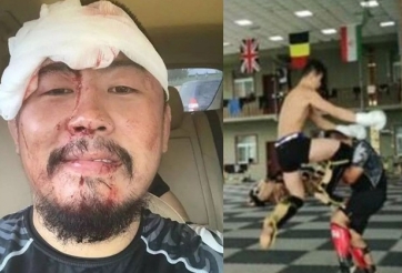 Nhận lời thách đấu, 'gã điên' MMA Trung Quốc bị đánh phải khâu 26 mũi