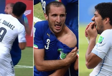 Chiellini: 'Suarez đã đúng khi cắn tôi tại World Cup 2014'