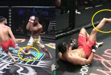 VIDEO: Võ sĩ MMA bị gãy chân ghê rợn khi tung cú đá vào đối thủ
