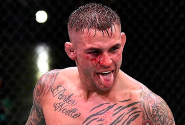 Dana White phải thôi 'làm trò' với Conor và Poirier? 