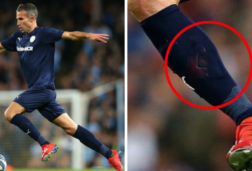 Robin Van Persie mang đệm ống đồng của MU trong trận tri ân Kompany