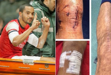 5 ngôi sao đứt dây chằng như Xuân Trường sau đó hồi phục và trở lại mạnh mẽ