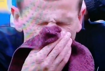 HÀI HƯỚC: Cầu thủ tự lên gối vào mặt mình vì móc bóng hụt