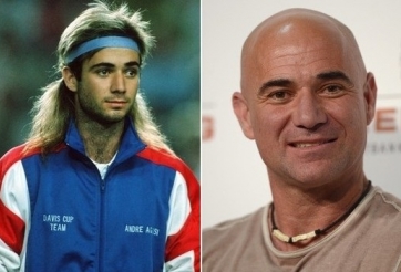 Huyền thoại tennis mất chức vô địch chỉ vì bộ tóc giả