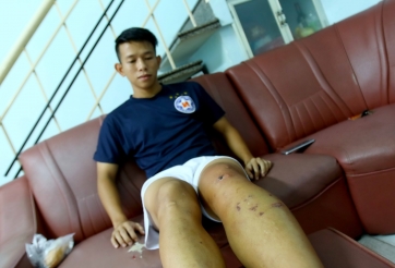 Anh Khoa: ‘Anh em đi đá bóng cần phải giữ nồi cơm cho nhau’