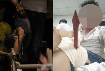 CĐV Thanh Hóa gặp chấn thương kinh hoàng trên sân Vinh