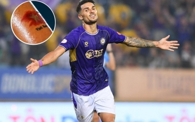 Hoàng Hên 'bật mí' ý nghĩa của hình xăm đặc biệt