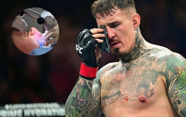 Tom Aspinall phẫu thuật mắt thành công, chưa ấn định thời điểm trở lại UFC