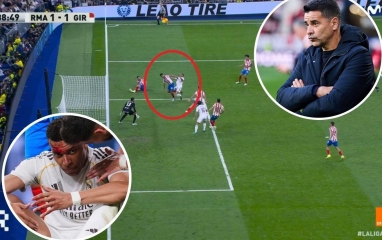 Mbappe đổ gục, phía Girona lên tiếng khiến Real nóng mặt