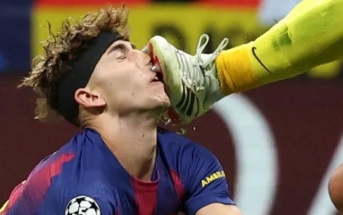 Sao Barca đổ máu kinh hoàng trong trận thua trước Atletico Madrid