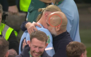 Pep Guardiola lại xuất hiện với vết xước trên đầu