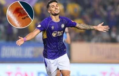 Hoàng Hên 'bật mí' ý nghĩa của hình xăm đặc biệt