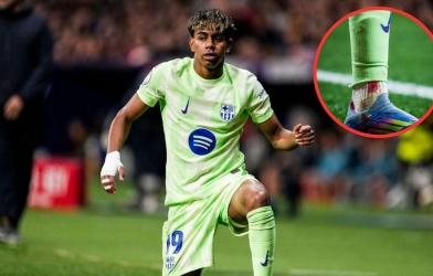 Yamal gây lo lắng với hình ảnh mới nhất