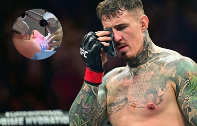 Tom Aspinall phẫu thuật mắt thành công, chưa ấn định thời điểm trở lại UFC