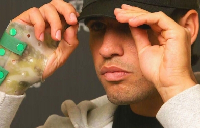 Alcaraz nguy cơ nghỉ thi đấu lâu hơn dự kiến