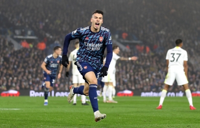 Cơn đau đầu dễ chịu của Mikel Arteta