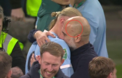 Pep Guardiola lại xuất hiện với vết xước trên đầu