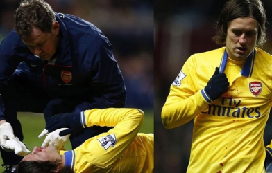 Bị vỡ mũi, Rosicky vắng mặt tại trận gặp Fulham