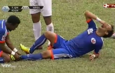 Video bóng đá: Cận cảnh chấn thương 'rùng rợn' của cầu thủ Than Quảng Ninh