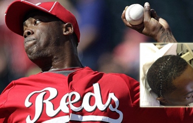 Cú đánh kinh hoàng khiến sao bóng chày vỡ xương mắt và mũi